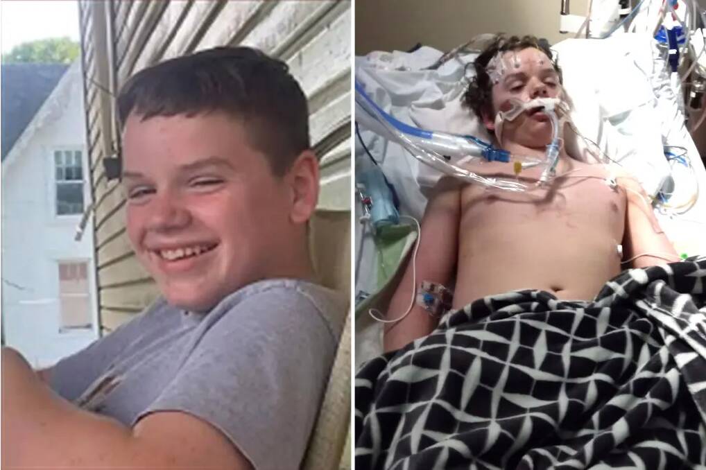 Jacob Steven's father, Justin, shared a picture of his son in hospital hooked up to a ventilator before he died on April 12, 2023. Mr Stevens wanted to warn parents about the deadly effects of the Benadryl challenge after his son was filmed downing 12-14 pills to induce hallucinations. Picture by Justin Stevens.